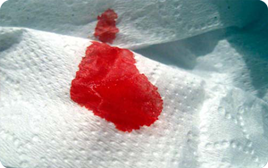 Sangre menstrual