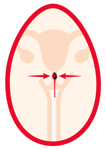 LANDING PAGE - SILEU KEGEL 9 LANDING PAGE - SILEU KEGEL INSTRUCCIONES 5 a